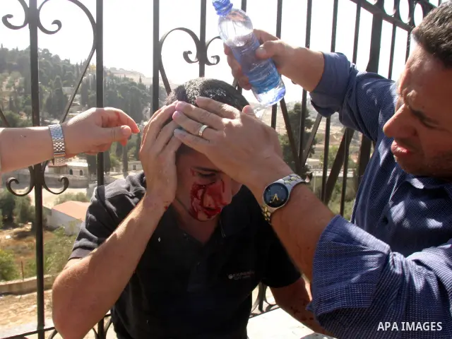 A wounded palestinian man outside the Al-Aqsa mosques compound in Jerusalem's Old City on October 4, 2009. Israeli police and Palestinian protestors clashed near Al-Aqsa, a flashpoint site sacred to Muslims and Jews that...