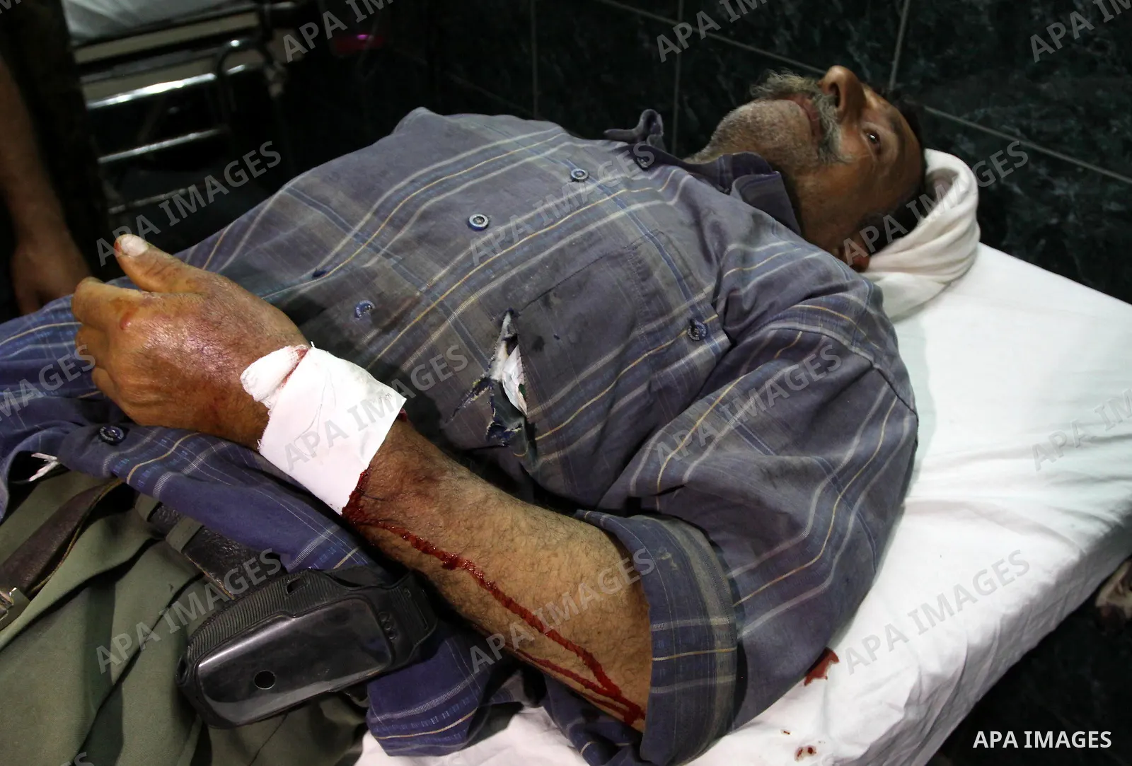 A Palestinian man receives treatment at Al-Shefa'a hospital after he injured by An Israeli tank shell explosion in Gaza city on May 27, 2010.Two Palestinian farmers were wounded when an Israeli tank shell exploded near t...
