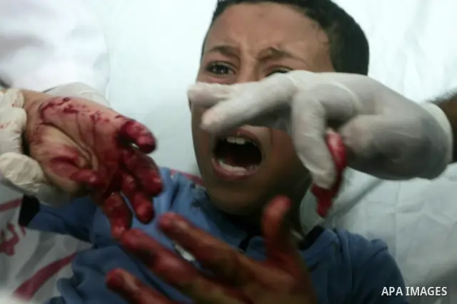 An Injured Palestinian receives medical care at the Al-Najar hospital in the southern Gaza Strip town of Rafah on October 20, 2010 . after they were hurt along with 11 others in an explosion inside a Hamas internal secur...