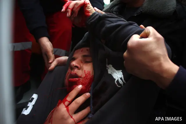 Palestinian medics help wounded Palestinian youths during a protest against the continued closure of Shuhada street to Palestinians, in the West Bank city of Hebron 25 February 2011. The activists gathered on Friday call...