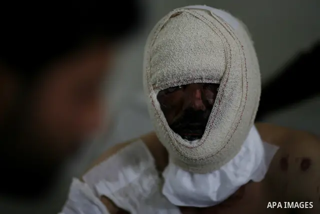 An injured Libyan rebel fighter receives treatment at a hospital after being evacuated from the besieged Libyan city of Misrata at the port in the eastern rebel stronghold of Benghazi on May 13, 2011. A ship carrying inj...