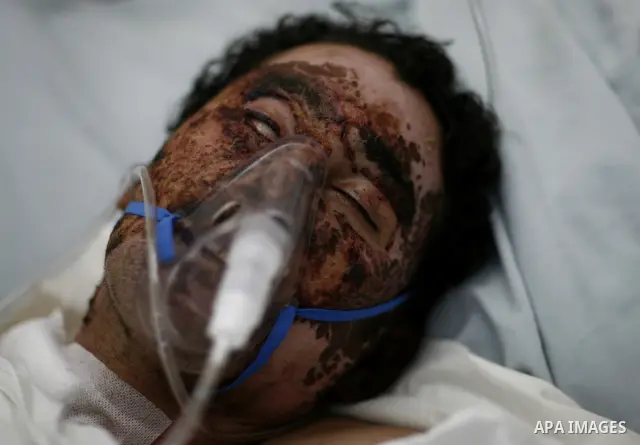 An injured Libyan rebel fighter receives treatment at a hospital after being evacuated from the besieged Libyan city of Misrata at the port in the eastern rebel stronghold of Benghazi on May 13, 2011. A ship carrying inj...