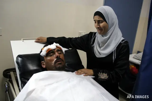 Palestinian man Njajat Maharb 37, From the village of Michmas in Ramallah in the West bank, recieves medical treatment at a hospital in Ramallah on on July 18, 2011. Maharb was apparnetly attacked by Jewish settlers from...