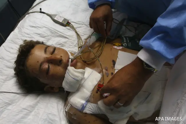 Ebrahim Al-Zaza, fifteen-years-old wounded Palestinian boy, receives a treatment inside the intensive care unit in al-Shefa hospital in Gaza City, Aug. 21, 2011. So far 15 Palestinians including three children were kille...
