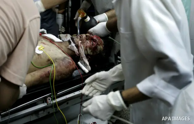 Palestinians doctors attend a wounded man at the Al Najar hospital following an Israeli air strike on a smuggling tunnel in Rafah, southern Gaza Strip, Thursday, Aug. 25, 2011. The Israeli military said its aircraft hit...