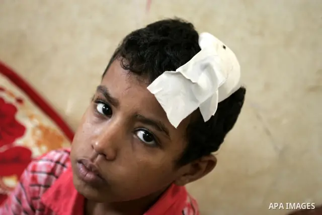 A Palestinian student, Bashir Ghaydah was injured in his head while playing in a school grounds of the Relief and Works Agency refugees "UNRWA" in Rafah, southern Gaza Strip on Sep. 25, 2011. UNRWA refuses to provide tre...
