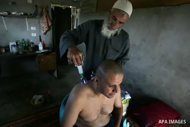 Palestinian therapist Rabhy Abu Jazar treats a patient suffering from backache and headaches using a form of cupping therapy which extracts blood from the patient, at his clinic in the Rafah refugee camp, southern Gaza S...
