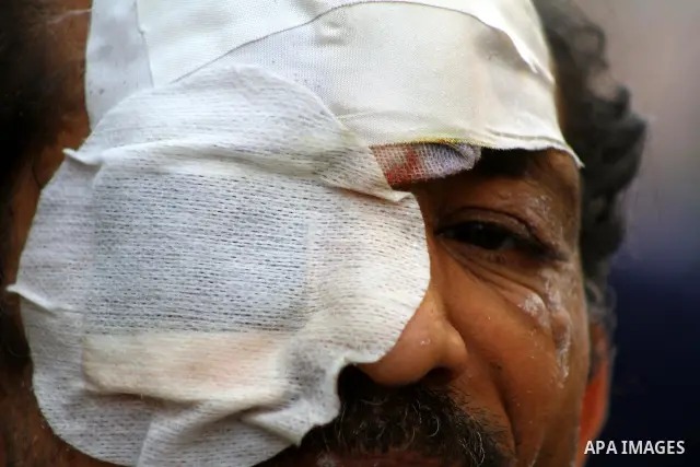 An injured protester hangs spent police tear gas canisters around his neck during clashes with riot police in a side street near Tahrir Square in Cairo November 22, 2011. Photo by Ashraf Amra