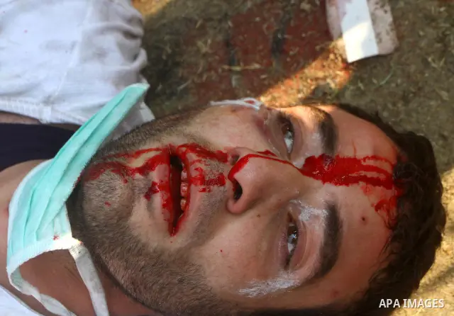 Protesters help another protester injured during clashes with riot police near Tahrir square in Cairo, Egypt, Wednesday, Nov. 23, 2011. Egyptian police are clashing with anti-government protesters for a fifth day in Cair...