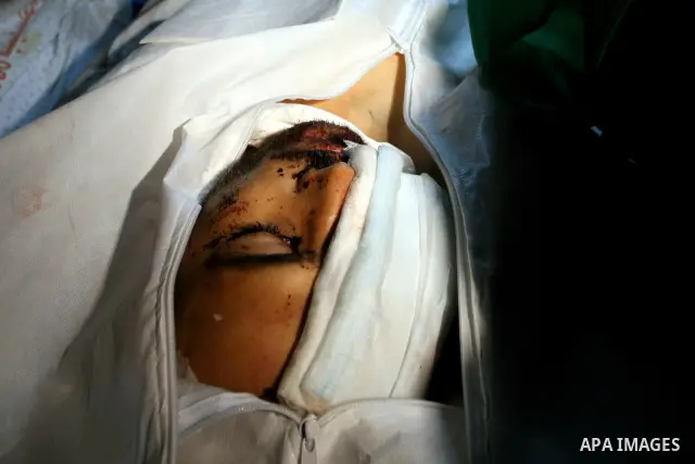 The body of Mustafa Tamimi is seen at the morgue of Ramallah Hospital in the West Bank city of Ramallah, Saturday, Dec. 10, 2011. Tamini, 28, was hurling rocks at an Israeli military vehicle on Friday in the West Bank vi...