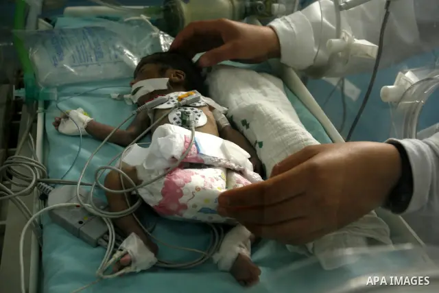 Premature babies receive treatment in the Nasser hospital in Khan Younis, southern Gaza Strip on February 15, 2012 as the hospital suffer from running out of fuel. Palestinian Ministry of Health in Gaza, calls for the Ar...