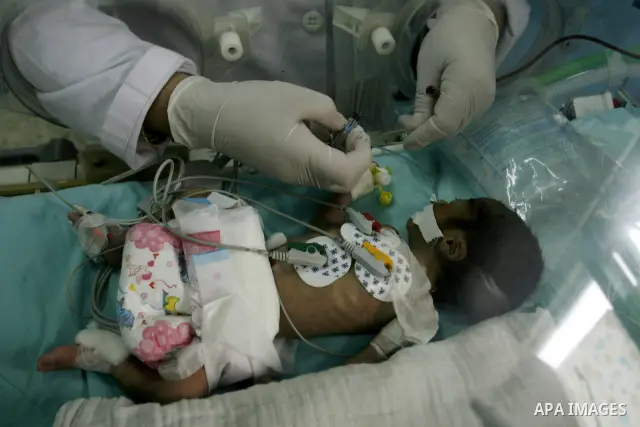 Premature babies receive treatment in the Nasser hospital in Khan Younis, southern Gaza Strip on February 15, 2012 as the hospital suffer from running out of fuel. Palestinian Ministry of Health in Gaza, calls for the Ar...