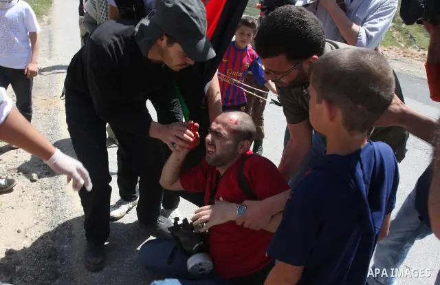 Palestinian local free lance photographer Ahmad Daghlas gets medical help after having been hit in the head by a tear gas grenade being shot by Israeli soldiers, during clashes at the Palestinian weekly Friday protest in...