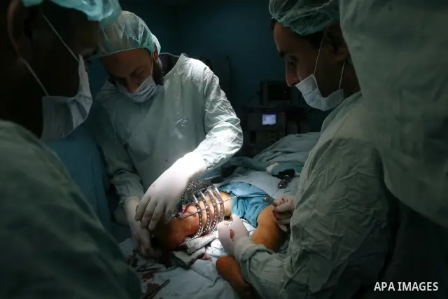 Palestinian doctors perform the first surgery to lengthen a child, "dwarf" in Abu Yousef Al Najjar hospital in Rafah city in the southern Gaza Strip, on April,15, 2012. Photo by Eyad Al Baba