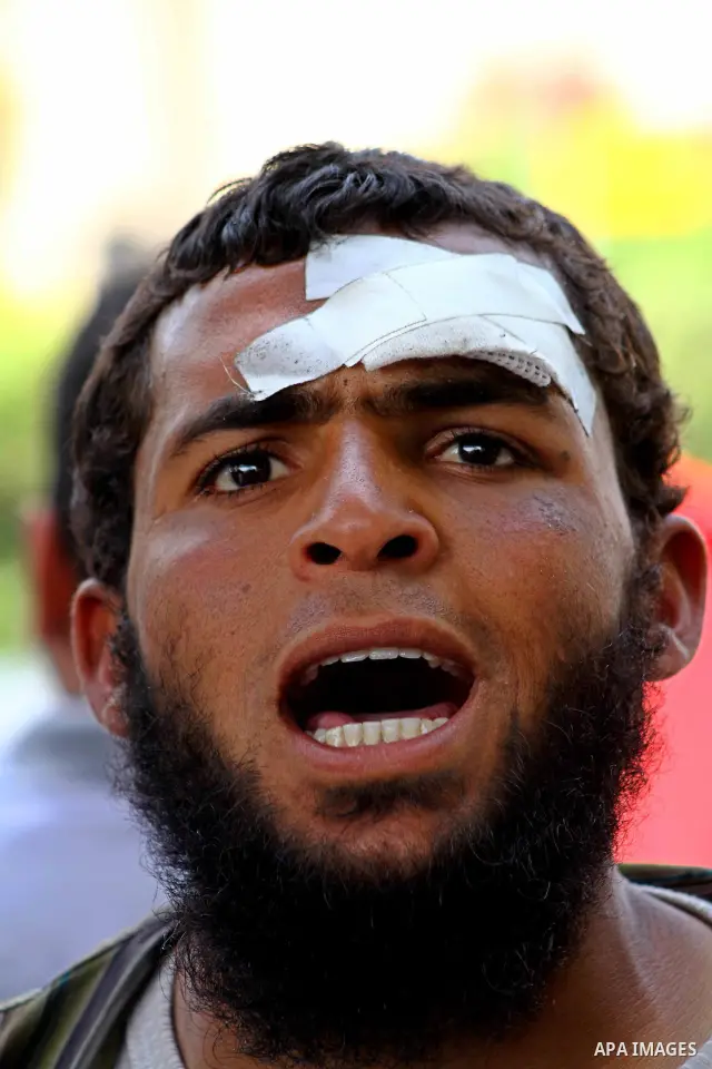 An Egyptian man injured in clashes between protesters and military near the Ministry of Defense in the Abbassiya district of Cairo May 01, 2012. Protesters demanded that their military rulers pledge to hand over power by...
