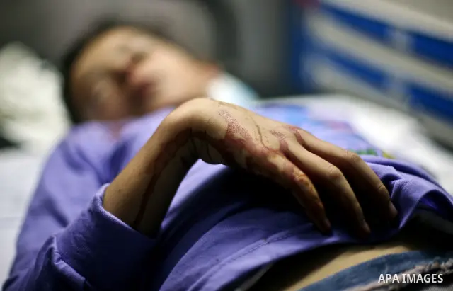 A Palestinian boy wounded by Israeli air strikes on Gaza City on June 20, 2012. There was no let-up in rocket fire from Gaza with at least 10 hitting the Jewish state despite seven Israeli air strikes overnight, police a...