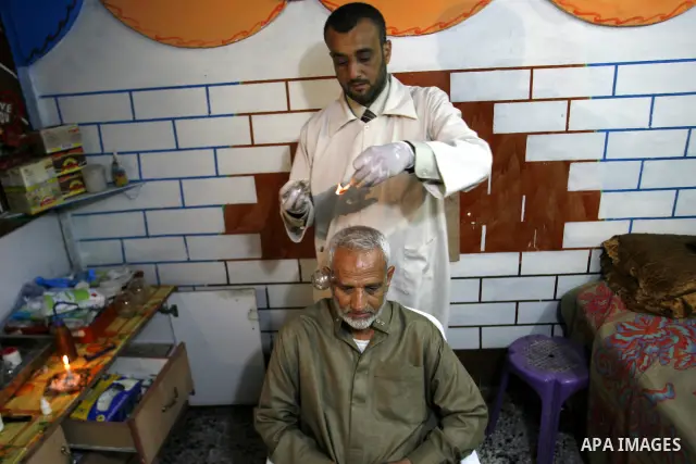 Anwar Sheikh-Eid, 42, performs Hijama or cupping therapy, to Palestinian patient Musa Sheikh El Eid at his shop in the southern Gaza Strip city of Rafah on 27 June 2012. Cupping is an ancient form of alternative medicine...