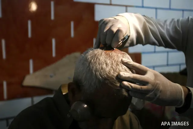 Anwar Sheikh-Eid, 42, performs Hijama or cupping therapy, to Palestinian patient Musa Sheikh El Eid at his shop in the southern Gaza Strip city of Rafah on 27 June 2012. Cupping is an ancient form of alternative medicine...