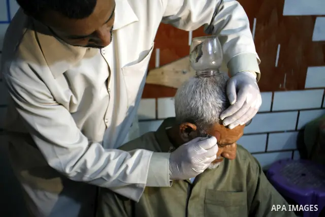 Anwar Sheikh-Eid, 42, performs Hijama or cupping therapy, to Palestinian patient Musa Sheikh El Eid at his shop in the southern Gaza Strip city of Rafah on 27 June 2012. Cupping is an ancient form of alternative medicine...