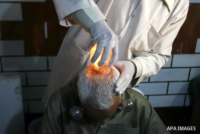 Anwar Sheikh-Eid, 42, performs Hijama or cupping therapy, to Palestinian patient Musa Sheikh El Eid at his shop in the southern Gaza Strip city of Rafah on 27 June 2012. Cupping is an ancient form of alternative medicine...