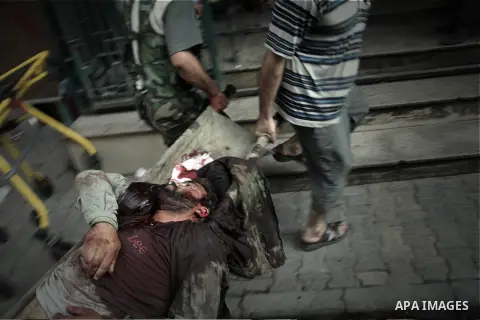 A Free Syrian fighter is brought to the Dar al-Shifa hospital in the northern city of Aleppo to be treated for his wounds on September 27, 2012, as fighting in Syria's second largest city between rebel forces and governm...