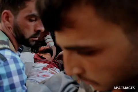 A Free Syrian fighter is brought to the Dar al-Shifa hospital in the northern city of Aleppo to be treated for his wounds on September 27, 2012, as fighting in Syria's second largest city between rebel forces and governm...