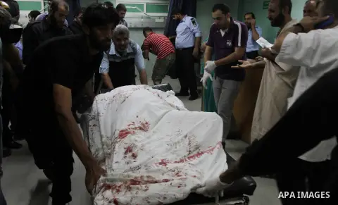 Palestinian medics check a wounded man at al-Shefa hospital in Gaza City following an Israeli airstrike in northern town of Jabaliya, in the Gaza Strip, on October 13, 2012. The air strike killed one Palestinian and woun...
