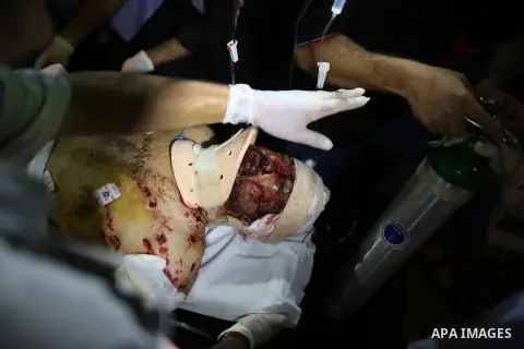 Palestinian medics check a wounded man at Kamal Odwan hospital in northen Gaza strip following an Israeli airstrike in northern town of Jabaliya, in the Gaza Strip, on October 13, 2012. The air strike killed one Palestin...
