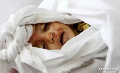 An image shows the body of one and a half year-old baby, Iyad Abu Khoussa, during his funeral at a mosque in Bureij Refugee Camp, central Gaza Strip, Sunday, Nov. 18, 2012. The baby boy was one of five Palestinian childr...