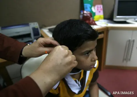 A Palestinian woman helps her deaf boy to put his ear hearing aid at a deaf center in preparation for implant a cochlear, in Gaza city on May 27, 2013. Cochlear implants may help provide hearing in patients that are not...