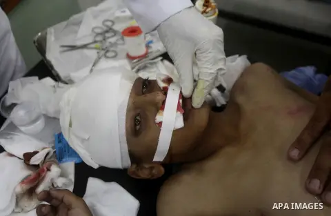 Palestinian medics treat a wounded boy at a hospital in Beit Lahia northern Gaza Strip, June 24, 2013. A Palestinian boy was killed and 25 others were wounded on Monday when a bus transporting prisoners' relatives collid...