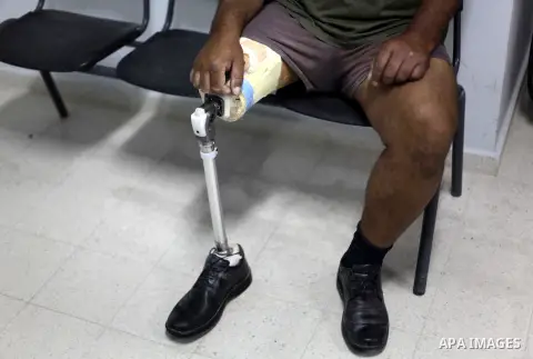 Palestinian men who lost their leg, play a sport exercises during a visit Peter Maurer, president of the International Committee of the Red Cross (ICRC), for Artificial Limbs and Polio Center in Gaza City on July 2, 2013...