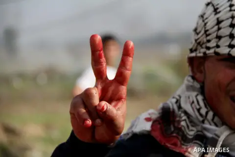 A Palestinian protester flashes a victory sign with his bloody hand during clashes with Israeli forces near the Nahal Oz border crossing with Israel, east of Gaza City on January 17, 2014. The Israeli army fired live rou...