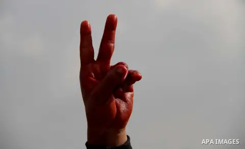 A Palestinian protester flashes a victory sign with his bloody hand during clashes with Israeli forces near the Nahal Oz border crossing with Israel, east of Gaza City on January 17, 2014. The Israeli army fired live rou...