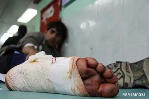 A Palestinian protester wounded by Israeli forces during clashes near the border with Israel, east of Jabalia refugee camp, lies on a hospital bed in Gaza City on February 14, 2014. The Israeli army fired live rounds and...