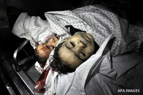Bodies of Palestinian children are seen at the morgue of the al-Shifa hospital in Gaza City, on July 20, 2014 July 20, 2014. The death toll in Gaza passed 400 as Israel pressed its biggest offensive in the enclave in fiv...