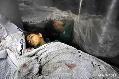 The Body of a Palestinian girl is seen lies at the morgue of the al-Shifa hospital in Gaza City, on July 20, 2014 July 20, 2014. The death toll in Gaza passed 400 as Israel pressed its biggest offensive in the enclave in...