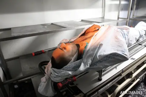The body of Mahmoud Shawamreh, 22, lies at a hospital morgue in the West Bank City of Ramallah July 21, 2014. An Israeli soldier shot dead a Palestinian who had been throwing stones at his car north of Jerusalem in the W...