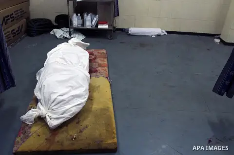 The body of a Palestinian man, who medics said was killed by Israeli shelling, lies at al-Shifa hospital morgue in Gaza City on July 21, 2014. The Palestinian death toll in an Israeli offensive in the Gaza Strip jumped t...