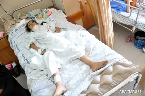 A Palestinian girl, who medics said was wounded in an Israeli air strike, lies on a bed at al-Shifa hospital in Gaza City on July 22, 2014. The Israeli operation in the Gaza Strip is entering the third week with 27 Israe...