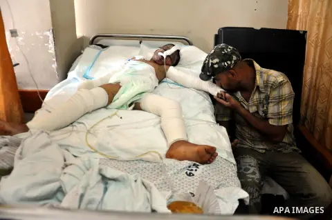 A Palestinian man kisses his son hand, who medics said was wounded in an Israeli air strike, as he receives treatment at al-Shifa hospital in Gaza City on July 22, 2014. The Israeli operation in the Gaza Strip is enterin...