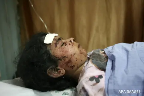 A Palestinian girl, who medics said was wounded in Israeli shelling, receives treatment at a hospital in Khan Younis in the southern Gaza Strip July 23, 2014. Israeli forces pounded Gaza on Wednesday, meeting stiff resis...