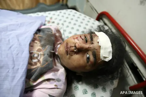 A Palestinian girl, who medics said was wounded in Israeli shelling, receives treatment at a hospital in Khan Younis in the southern Gaza Strip July 23, 2014. Israeli forces pounded Gaza on Wednesday, meeting stiff resis...