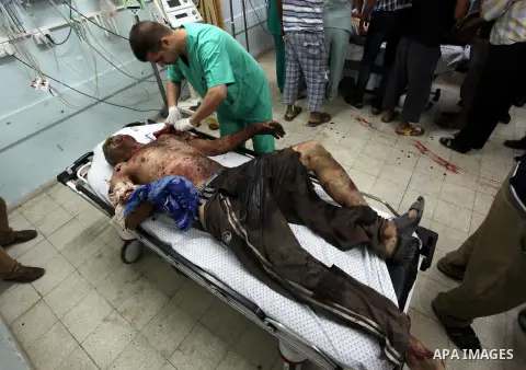 A Palestinian man, wounded following an Israeli air strike, arrives at Nasser hospital in Khan Yunis in the southern Gaza Strip on July 25, 2014. An Israeli defense official says the Israeli Security Cabinet is meeting t...