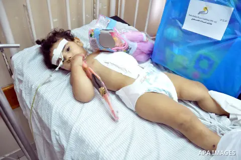 Palestinian Children rests at the Shifa hospital to receiving treatment on the first day of the Muslim festival of Eid al-Fitr in Gaza City on July 28, 2014. on the beginning of the Muslim Eid festival ending the month-l...