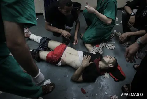 Palestinians wheel a wounded man, injured from an Israeli Strike in Shijaiyah neighborhood, to an emergency room at Shifa Hospital, in Gaza City, Wednesday, July 30, 2014. Photo by Ezz al-Zanoun