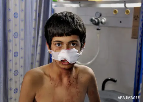 A Palestinian, boy whom medics said was wounded in an Israeli air strike at a hospital in Gaza City July 31, 2014. Israeli Prime Minister Benjamin Netanyahu, facing international alarm over a rising civilian death toll i...