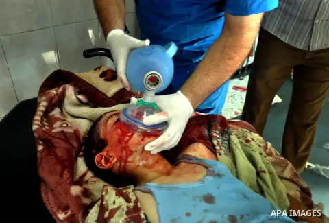 An injured Palestinian boy receives medical treatment at al-shifa hospital in Gaza city , following an Israeli military strike on August 1, 2014. Egypt told Palestinian officials it is delaying ceasefire talks in Cairo a...