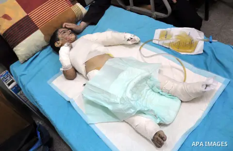 Palestinian Children rests at the Shifa hospital to receiving treatment, in Gaza City, on August 2, 2014. The Israeli army gave a first indication it was ending operations in parts of Gaza, while continuing to bombard ot...