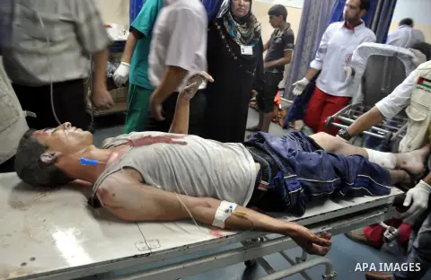 A Palestinian boy, wounded in an Israeli air strike on the al-Shati refugee camp, lies on a stretcher as he is treated at the al-Shefa hospital in Gaza City, on August 4, 2014. An eight-year-old girl was killed and 30 pe...